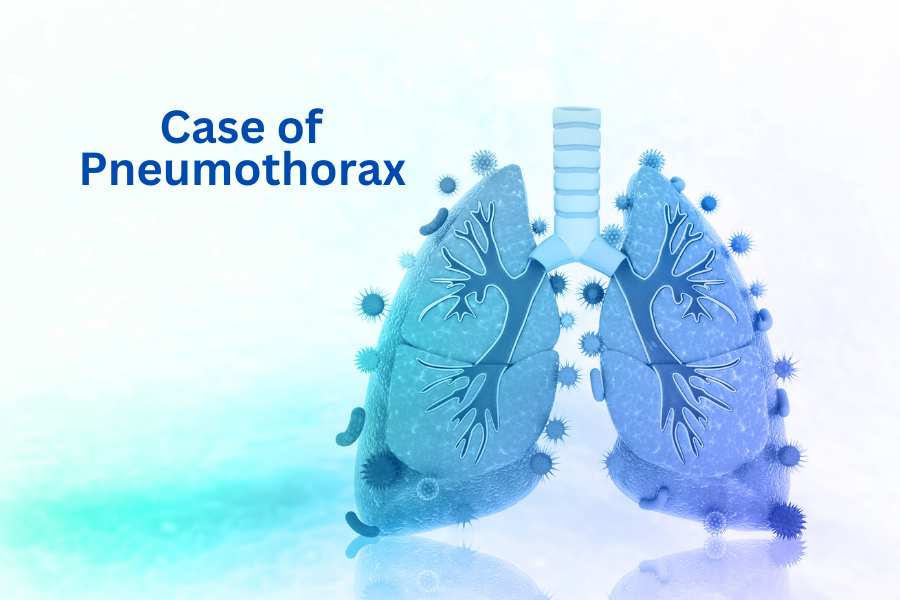 Visualization of the lung